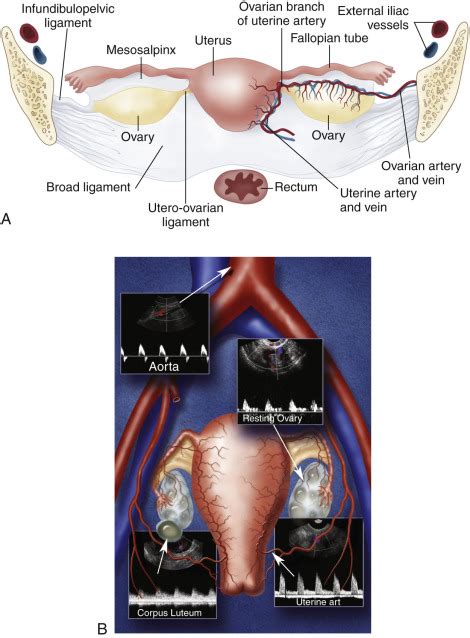 Duplex Ultrasound Evaluation Of The Uterus And Ovaries Radiology Key