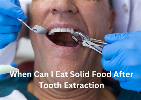 When Can I Eat Solid Food After Tooth Extraction Common Cents Millennial
