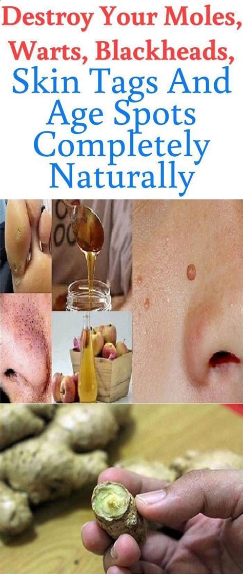The Best Natural And Most Effective Natural Remedies To Remove Brown