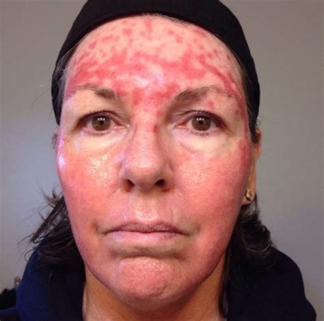 Sun Damage Dermatology Matters