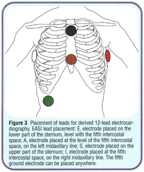 Academic Onefile Document Clinical Usefulness Of The