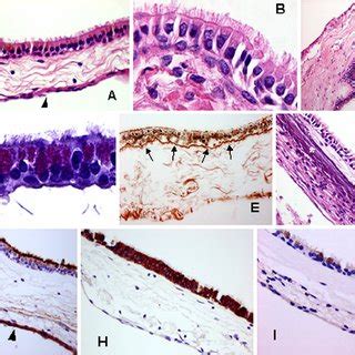 Photomicrographs Showing The Histological And Immunohistochemical