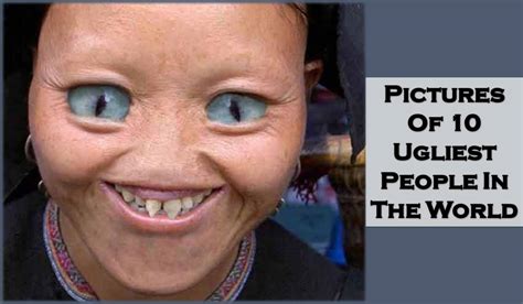 10 Pictures Of Horrible Looking People In The World