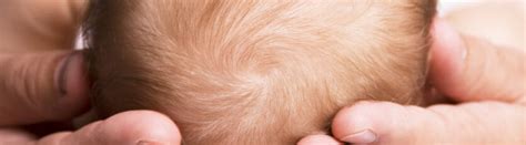 Babies Head Shape What To Know And When To Worry Applied Biomechanics