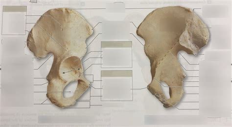 Lateral And Medial View Of Right Coxal Bone Diagram Quizlet