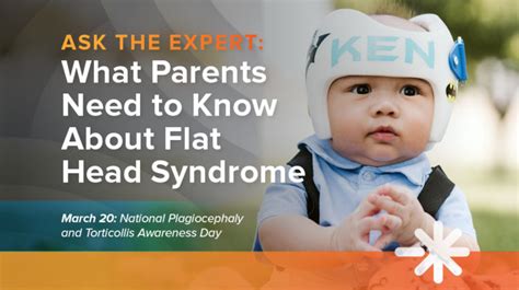 Hanger Clinic Blog What Parents Need To Know About Flat Head Syndrome