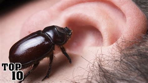Top 10 Scariest Things Found In Human Ears Youtube