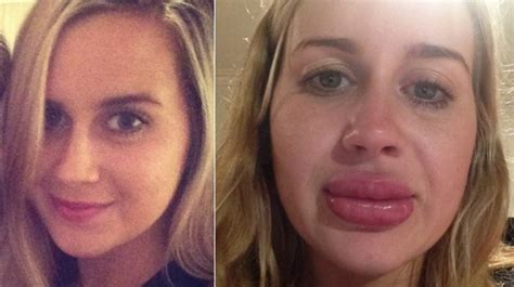 See What Happens When This Girl Tries A Lip Enhancing Gadget Stuff Co Nz