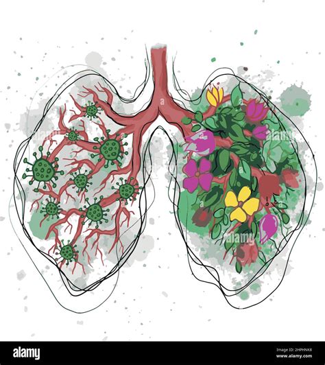 Healthy And Sick Lungs In Flowers And With Covid19 Virus Concept