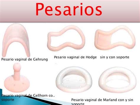 Pesarios Indicaciones Colocion Y Cuidados Dr Cesar N Castillo Fe