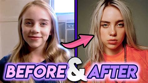 Billie Eilish Before And After Transformations 2019 Glow Up