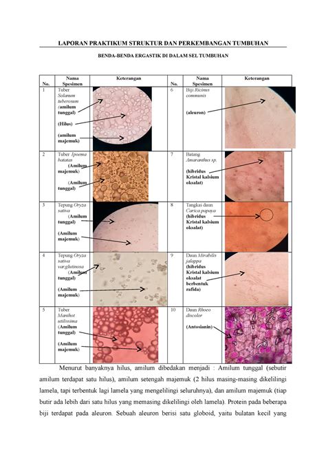 Laporan Praktikum Benda Benda Ergastik Di Dalam SEL Tumbuhan LAPORAN PRAKTIKUM STRUKTUR DAN