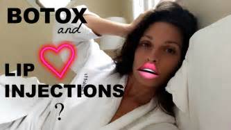 Botox Lip Injections Youtube