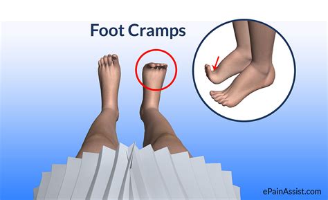 foot cramps treatment causes ways to get rid of cramps symptoms
