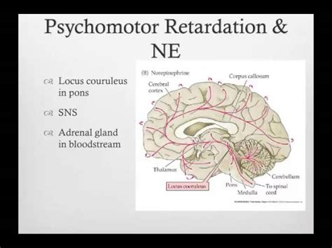 🌷 What Is Psychomotor Slowing Psychomotor Retardation Causes