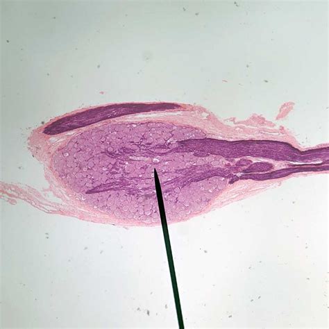Spinal Ganglion Histology