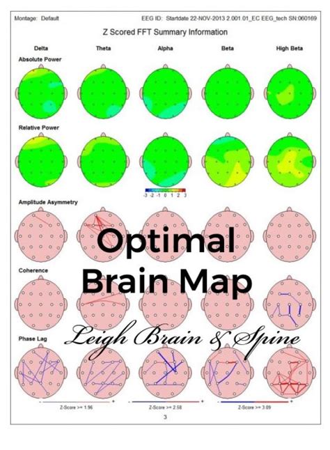 Qeeg And Brain Mapping How It Should Look Leigh Brain And Spine