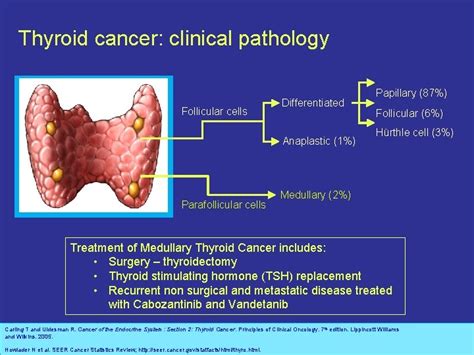 Management Advances For Differentiated And Medullary Thyroid Carcinoma