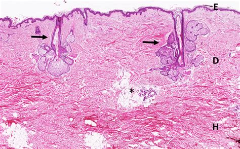 Normal Skin Histology Histology Shows Epidermis E Dermis D And