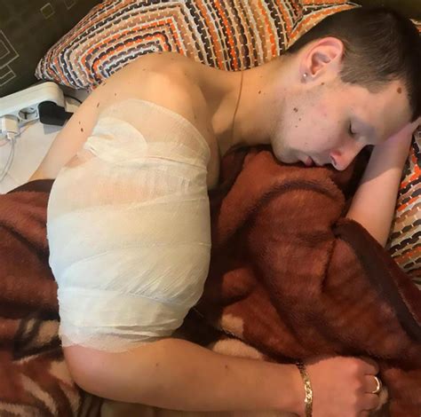 Synthol Kid Kiril Tereshin Fears Dying After Injecting Insane Amount Of