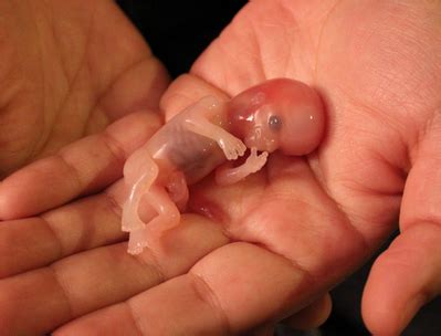 The menstrual cycle of a fertile woman repeats every 28 to 35 days, lasting for about 4 to 8 days. Blood Clots of Miscarriage: What It Looks Like? - New Kids Center