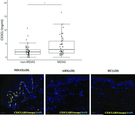 Pos The Role Of Cx Cl Cx Cr Axis In The Pathogenesis Of Anti