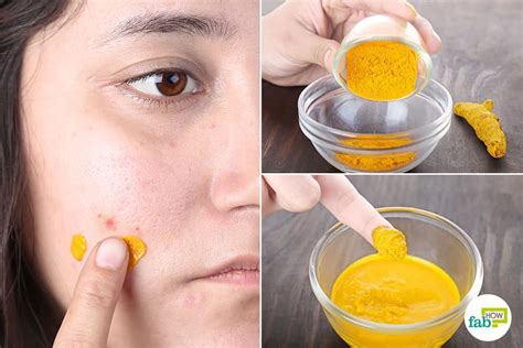How To Use Turmeric For Dark Spots 6 Methods That Work Fab How