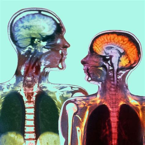 Mens And Womens Brains Appear To Age Differently