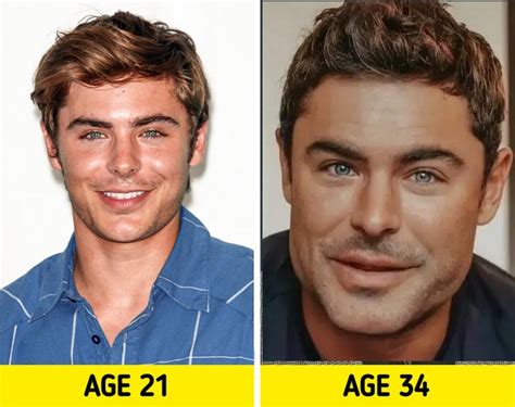 Zac Efron S Chin Injury And Plastic Surgery Explained