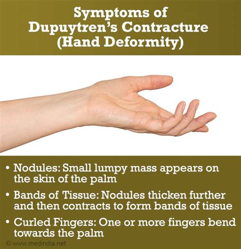 Dupuytrens Contracture Vikings Disease Causes Risk Factors