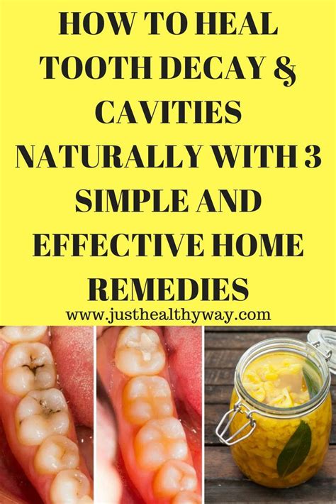 How To Heal Tooth Decay And Cavities Naturally With 3 Simple And