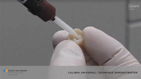 Watch A Demonstration On Using Calibra Universal Self Adhesive Resin