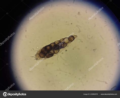 Demodex Parasite Under Skin In Dog Or People Take Photo From Microscope