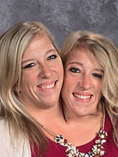 abby and brittany hensel — see what the famous conjoined twins look like today conjoined