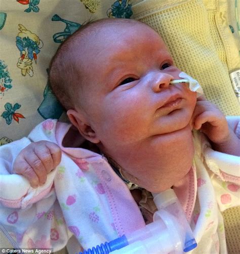 Toddler Born With Tumour Crushing Windpipe Speaks To Her Dad In Sign