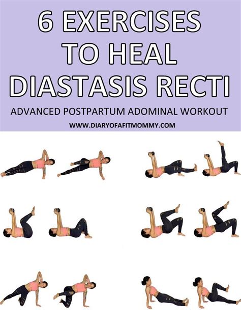 6 Exercises To Fix Heal Diastasis Recti Artofit