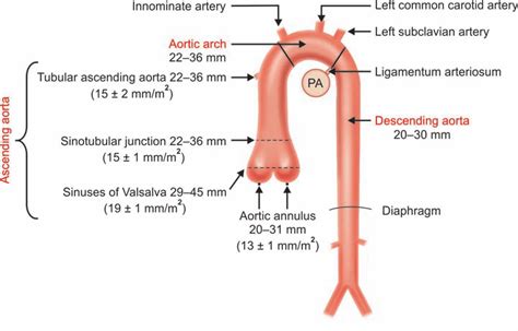 8 Aorta And Its Normal Size Range Download Scientific Diagram