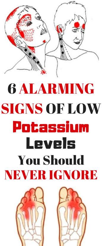 6 alarming signs of low potassium levels you should never ignore how to stay healthy