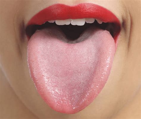 White Bumps On Tongue Causes And Treatment