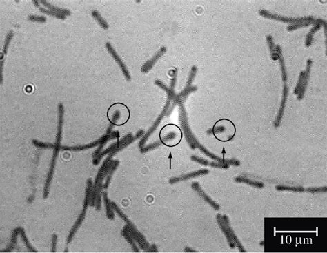 Photomicrograph Of Filamentous Bacteria With Spores Cells Stained By