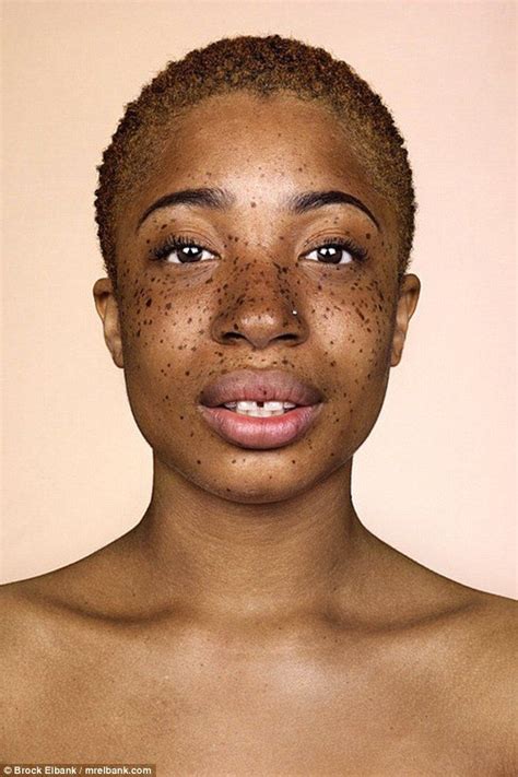 Photographer Captures Freckles In All Their Glory Sommersprossen Menschen Mit Sommersprossen