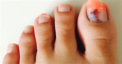 Thoughts Attic Bruised Toe