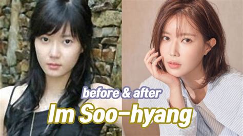 Im Soo Hyang Before Plastic Surgery Has The Woori The Virgin Star