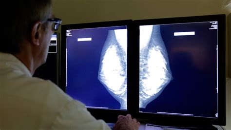Revolutionary Single Dose Breast Cancer Therapy Approved For Nhs Use