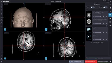 Medtronic Announces Most Advanced Stealthstation For Neurosurgery