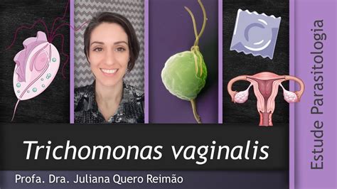 Aula Sobre Trichomonas Vaginalis Tricomon Ase Youtube Hot Sex Picture