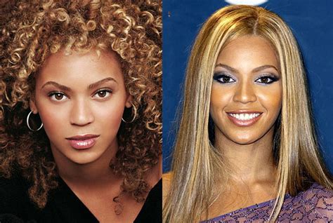 Beyonce Nose Job Before After Plastic Surgery