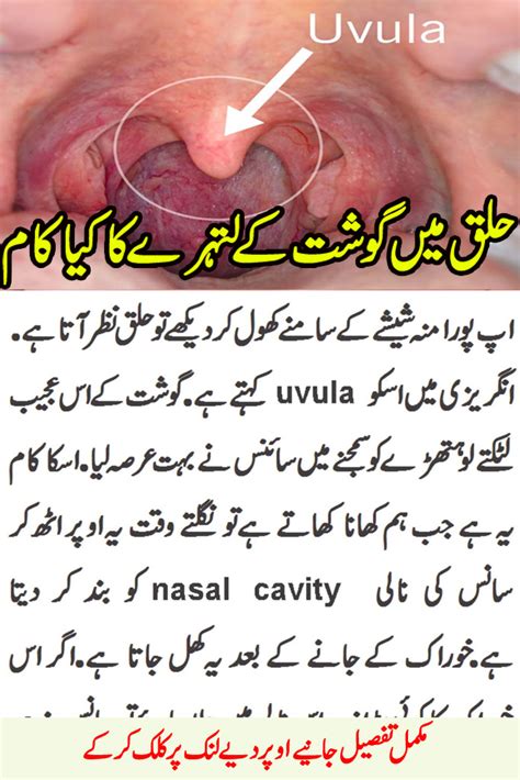Swollen Uvula Causes And Treatment For Uvulitis Daily