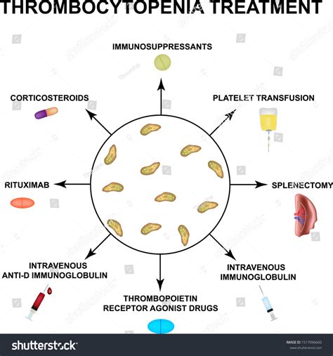 Thrombocytopenia Treatment Lowering Platelets Blood Infographics Stock