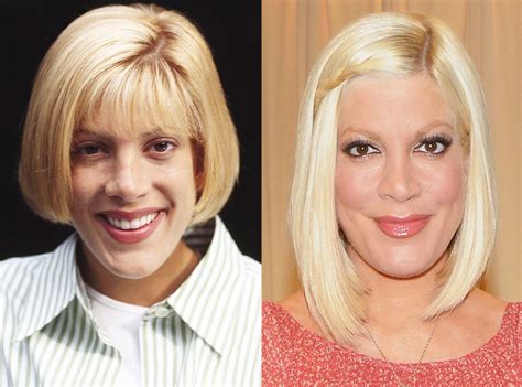 Tori Spelling From Celebs Who Ve Admitted To Getting Plastic Surgery E News